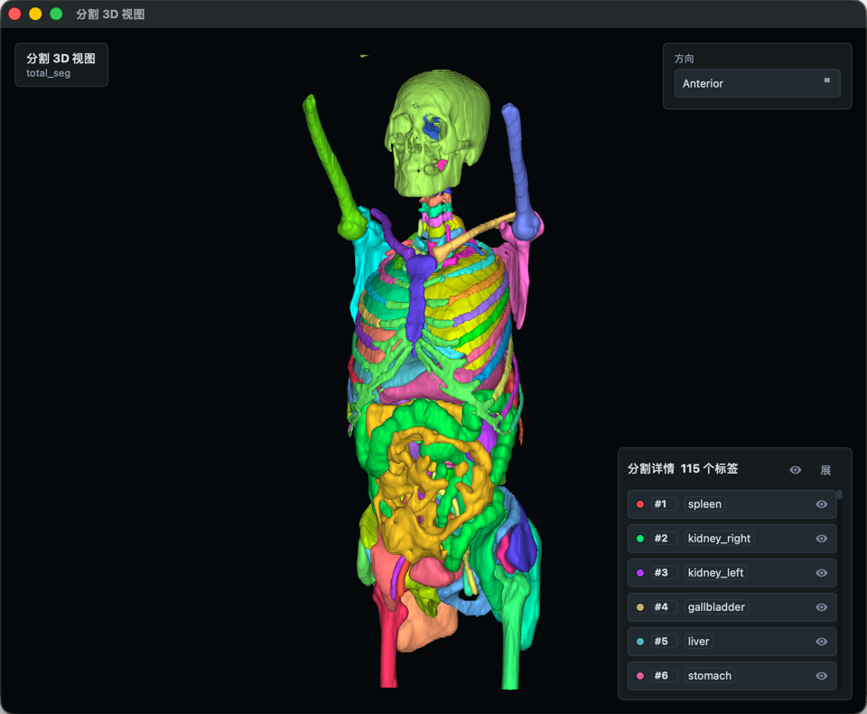 VisoRay 3D segmentation structure view