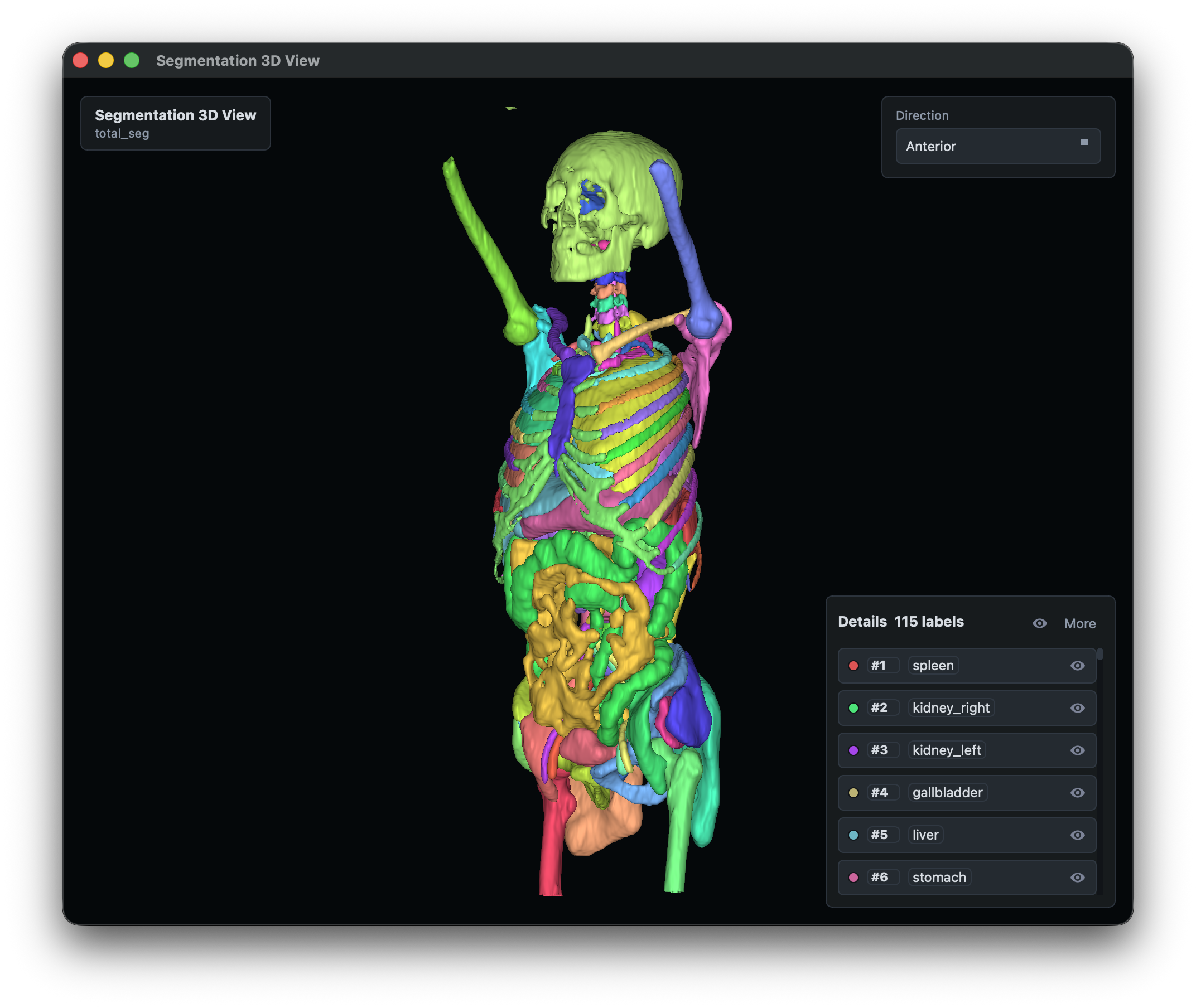VisoRay 3D segmentation structure view