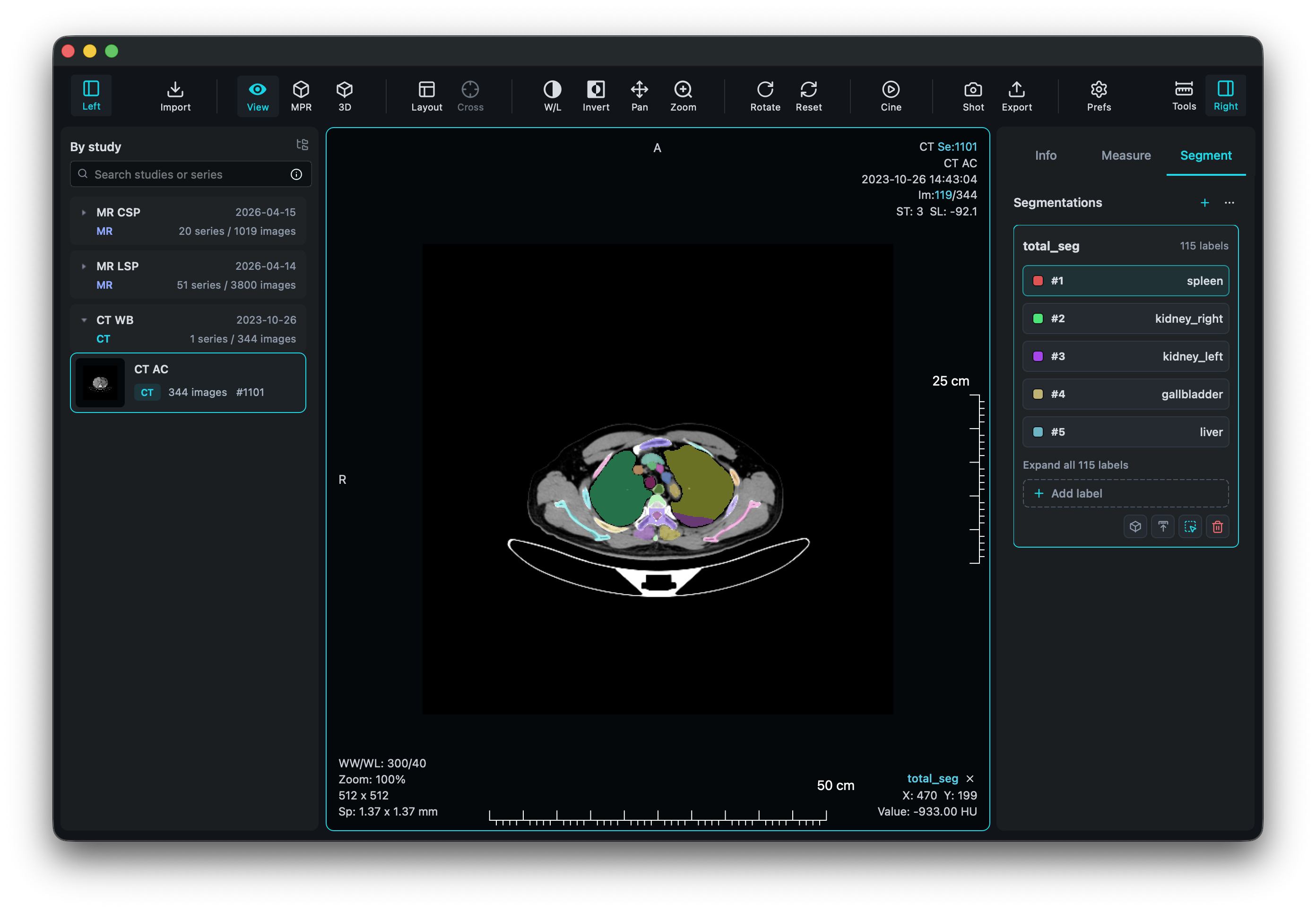 VisoRay segmentation overlay and label management interface